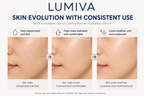 Barrier Hydration Serum